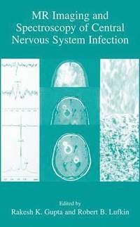bokomslag MR Imaging and Spectroscopy of Central Nervous System Infection