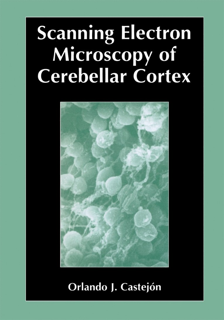 Scanning Electron Microscopy of Cerebellar Cortex 1