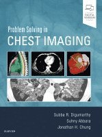 Subba R. Digumarthy, Suhny Abbara, Jonathan H. Chung - Problem Solving in Chest Imaging, Inbunden