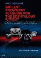 bokomslag Implant Treatment Planning for the Edentulous Patient