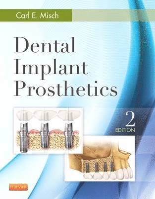 bokomslag Dental Implant Prosthetics