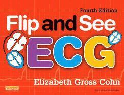 Flip and See ECG 1