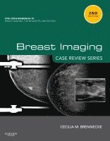 Cecilia M Brennecke - Breast Imaging: Case Review Series, Häftad