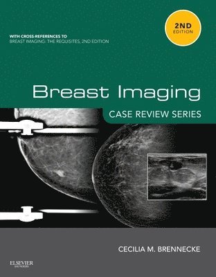 bokomslag Breast Imaging: Case Review Series