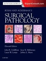 John R. Goldblum, Laura W. Lamps, Jesse K. McKenney - Rosai and Ackerman's Surgical Pathology - 2 Volume Set, Inbunden
