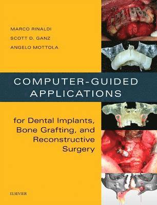 Computer-Guided Applications for Dental Implants, Bone Grafting, and Reconstructive Surgery (adapted translation) 1