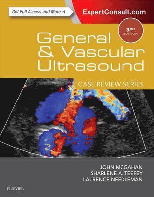 General and Vascular Ultrasound: Case Review 1