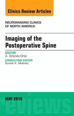 Orlando Ortiz - Imaging of the Postoperative Spine, An Issue of Neuroimaging Clinics, Inbunden