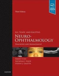 bokomslag Liu, Volpe, and Galetta's Neuro-Ophthalmology