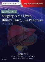 William R. Jarnagin - Blumgart's Surgery of the Liver, Biliary Tract and Pancreas, 2-Volume Set, Inbunden