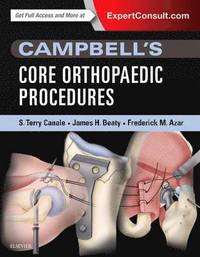 bokomslag Campbell's Core Orthopaedic Procedures