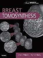 bokomslag Breast Tomosynthesis