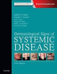 bokomslag Dermatological Signs of Systemic Disease