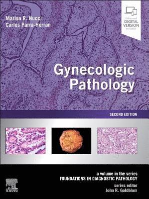 Gynecologic Pathology 1
