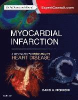 bokomslag Myocardial Infarction: A Companion to Braunwald's Heart Disease