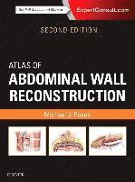 bokomslag Atlas of Abdominal Wall Reconstruction