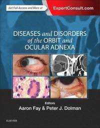 bokomslag Diseases and Disorders of the Orbit and Ocular Adnexa
