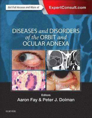 bokomslag Diseases and Disorders of the Orbit and Ocular Adnexa