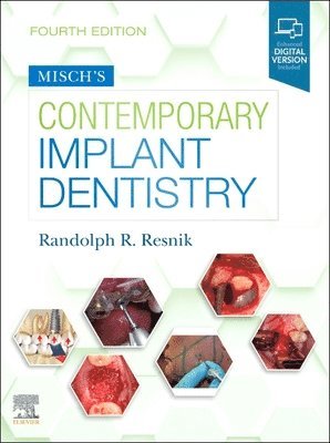 Misch's Contemporary Implant Dentistry 1