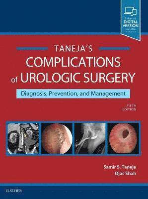 bokomslag Complications of Urologic Surgery