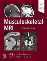 Nancy M. Major, Mark W. Anderson - Musculoskeletal MRI, Inbunden