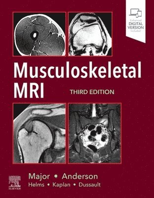 bokomslag Musculoskeletal MRI