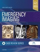 Jamlik-Omari Johnson - Emergency Imaging: Case Review Series, Häftad