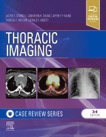 Justin T. Stowell, Jonathan H. Chung, Jeffrey P. Kanne, Theresa C. McLoud, Gerald F. Abbott - Thoracic Imaging: Case Review, Häftad