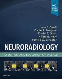 bokomslag Neuroradiology: Spectrum and Evolution of Disease