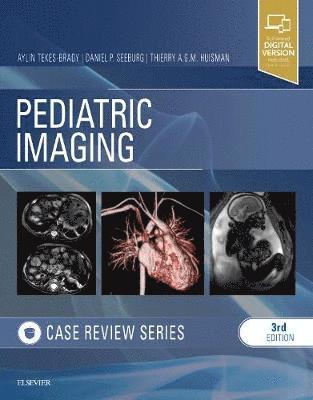 Pediatric Imaging: Case Review Series 1