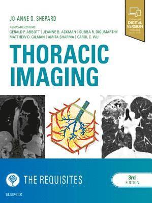 bokomslag Thoracic Imaging The Requisites