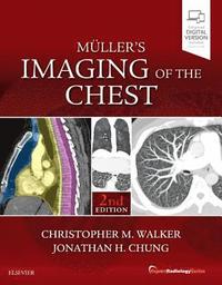 bokomslag Muller's Imaging of the Chest