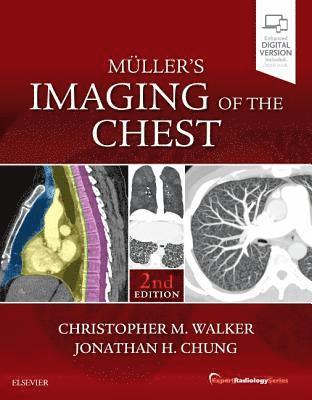 Muller's Imaging of the Chest 1