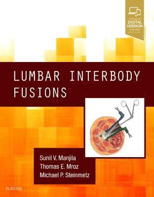 bokomslag Lumbar Interbody Fusions