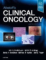 John E. Niederhuber, James O. Armitage, James H. Doroshow, Michael B. Kastan, Joel E. Tepper - Abeloff's Clinical Oncology, Inbunden