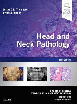 bokomslag Head and Neck Pathology