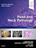 Lester D.R. Thompson, Justin A. Bishop, Lester D. R. Thompson, Lester D R Thompson, Justin A Bishop - Head and Neck Pathology, Inbunden