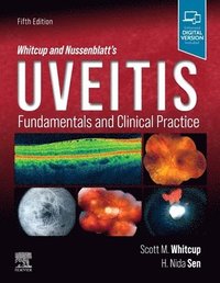 bokomslag Whitcup and Nussenblatt's Uveitis