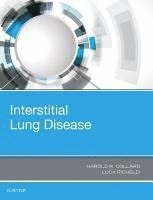 bokomslag Interstitial Lung Disease