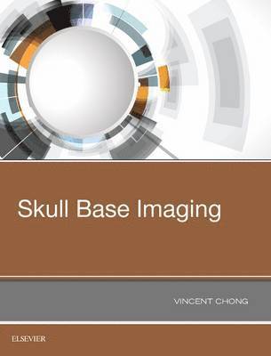 Skull Base Imaging 1