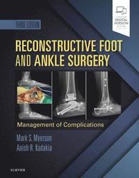 bokomslag Reconstructive Foot and Ankle Surgery: Management of Complications