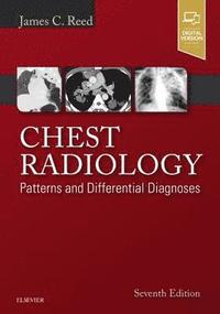 bokomslag Chest Radiology