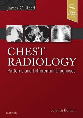 Chest Radiology 1