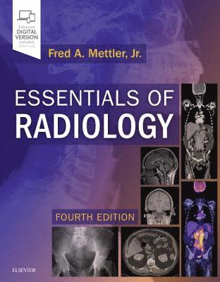 Essentials of Radiology 1