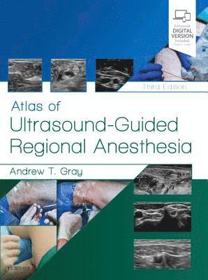 bokomslag Atlas of Ultrasound-Guided Regional Anesthesia