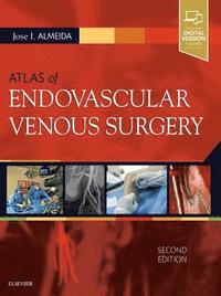 bokomslag Atlas of Endovascular Venous Surgery