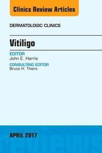 bokomslag Vitiligo, An Issue of Dermatologic Clinics