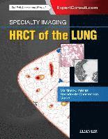 bokomslag Specialty Imaging: HRCT of the Lung