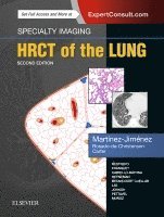 Santiago Mart�nez-Jim�nez, Melissa L. Rosado-de-Christenson, Brett W. Carter, Santiago Martínez-Jiménez, USA) Martinez-Jimenez, Santiago, MD (Department of Radiology, Saint Luke's Hospital of Kansas City, Professor of Radiology, University of Missouri-Kansas City School of Medicine, Kansas City, Missouri, USA) Rosado-de-Christenson, Melissa L., MD, FACR, FAAWR (Melissa L. Rosado-de-Christenson, MD, FACR, FAAWR, Attending Radiologist, Division of Cardiothoracic Imaging, Department of Medical Imaging, Banner - University Medical Group Tucson, Professor of Medical Imaging, University of Arizona College of Medicine - Tucson, Tucson, Arizona, MD Carter, Brett W. - Specialty Imaging: HRCT of the Lung, Inbunden