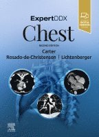Brett W. Carter, Melissa L. Rosado-de-Christenson, John P. Lichtenberger III, Santiago Mart�nez-Jim�nez - ExpertDDx: Chest, Inbunden